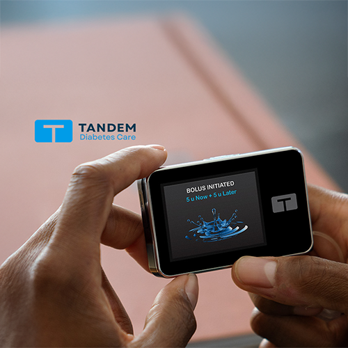 Continuous Glucose Monitor Device